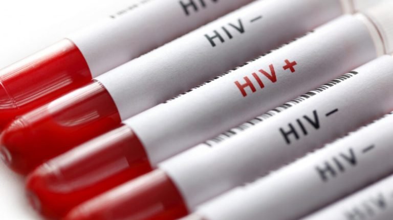 1.6 Million Nigerians On HIV Treatment – National Agency For Control Of AIDS