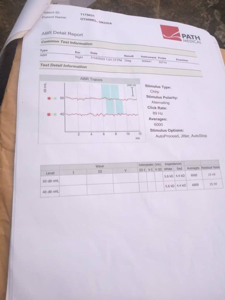 An Appeal For Medical Help: Re: Othniel Chimdiomimi-Amogu Ukoha For Cochlear Implant - Presbyterian Reverend Cries Out For Help 6 IMG 20250806 WA0023
